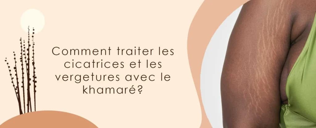 Comment traiter les cicatrices et les vergetures avec le khamaré